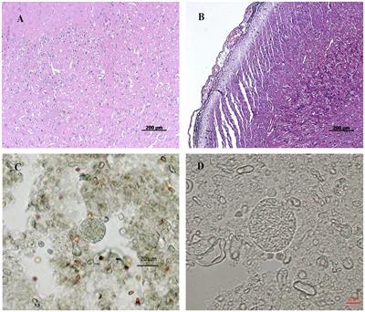 Global MicroRNAs Expression Profile Analysis Reveals Possible Regulatory Mechanisms of Brain Injury Induced by Toxoplasma gondii Infection